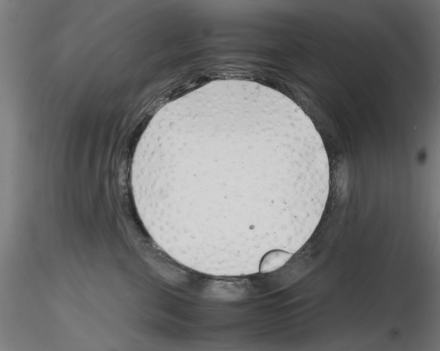 X0000116140571201001041035