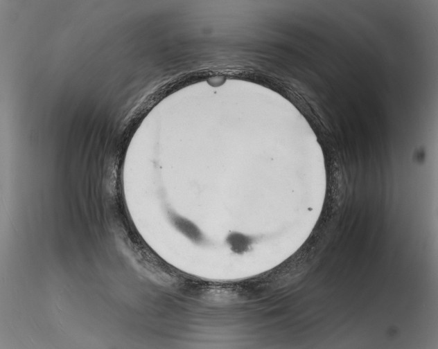 X0000116140596201001041034