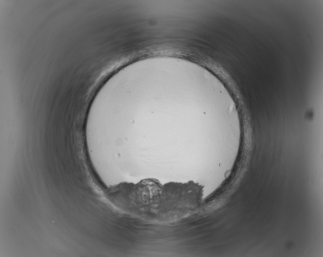 X0000116140625201001041033