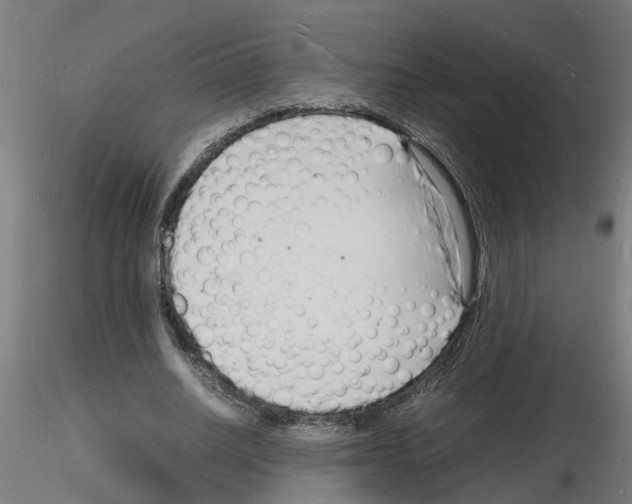 X0000116140630201001041033