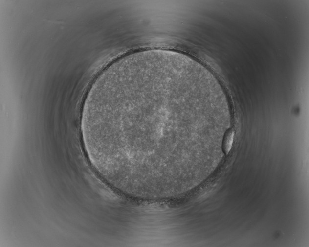 X0000116140673201001041033