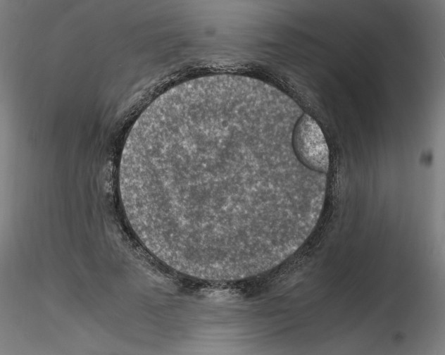 X0000116140689201001041033