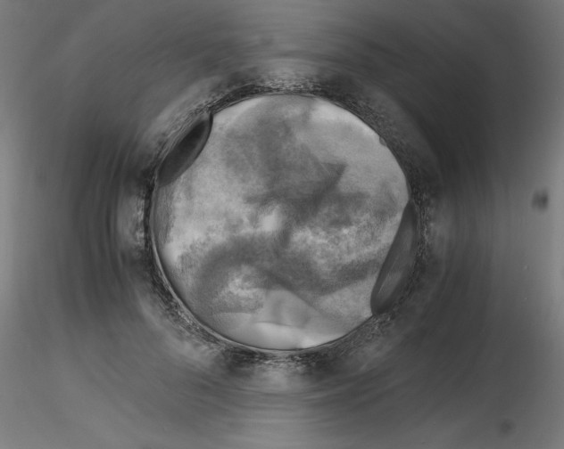 X0000116140696201001041033