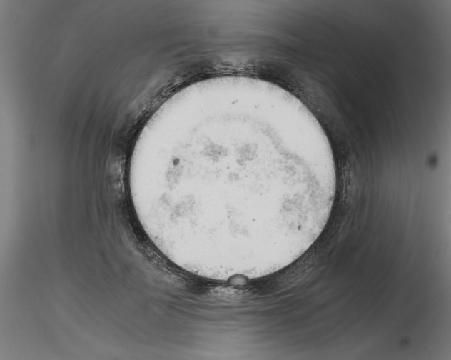 X0000116140699201001041032