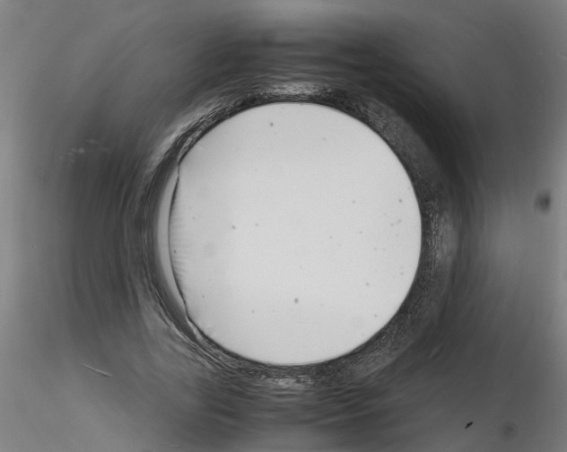 X0000116140731201001041032