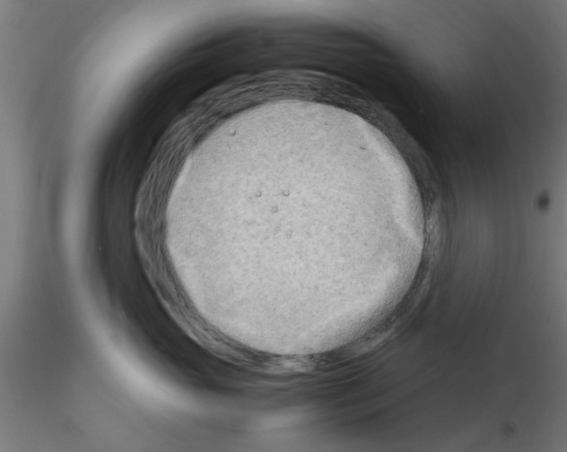 X0000116140765201001041032