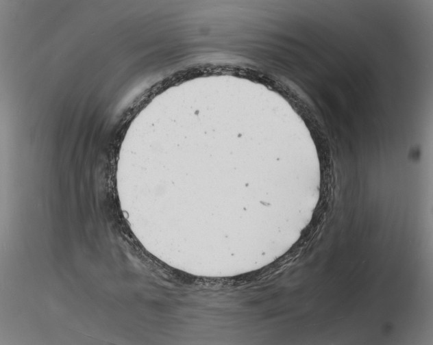 X0000116140775201001041031