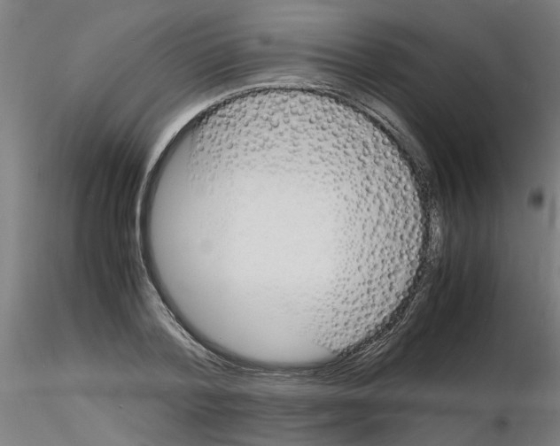 X0000116140788201001041031