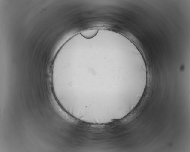 X0000116140859201001041031