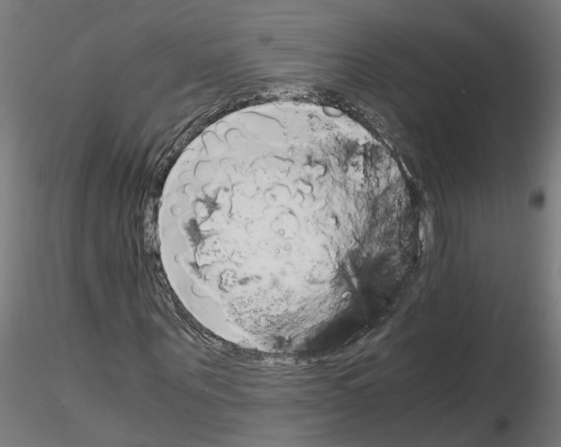 X0000116140867201001041030