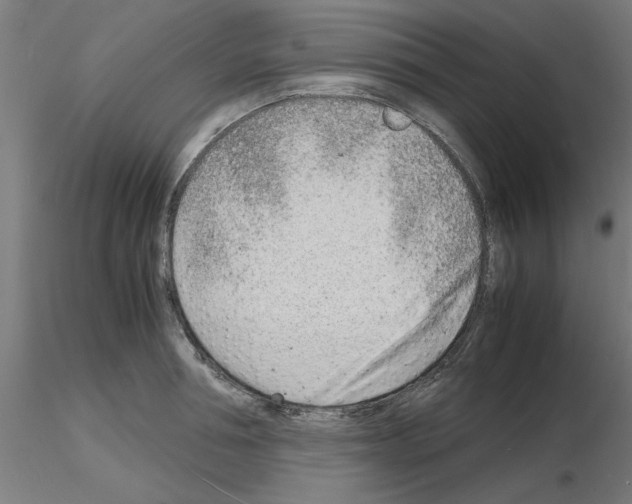 X0000116140994201001041028