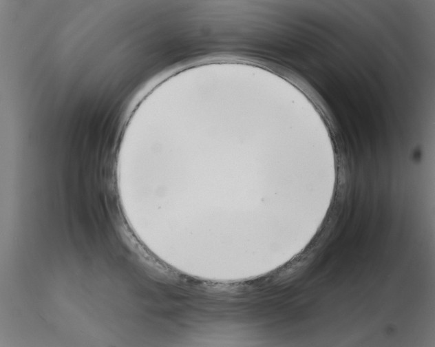 X0000116141004201001041028