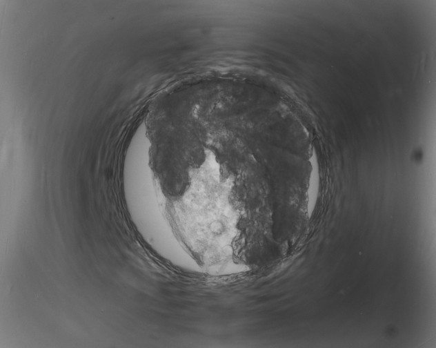 X0000116141009201001041028