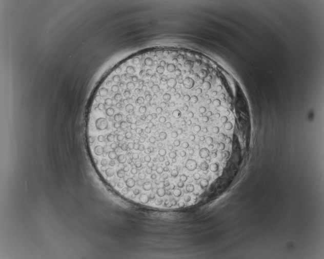 X0000116141045201001041028