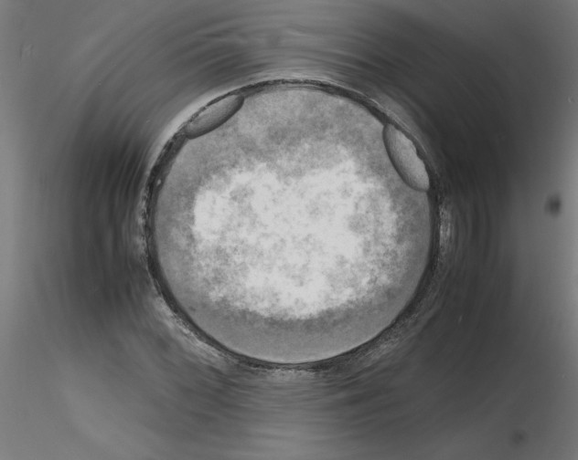 X0000116141068201001041027