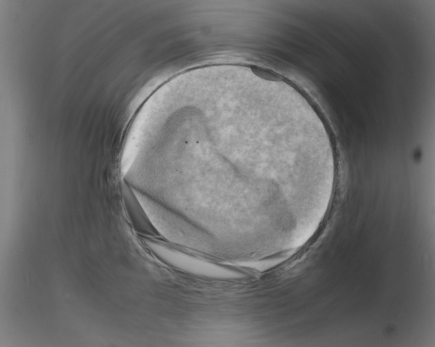 X0000116141097201001041027