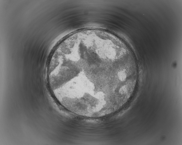 X0000116141125201001041027