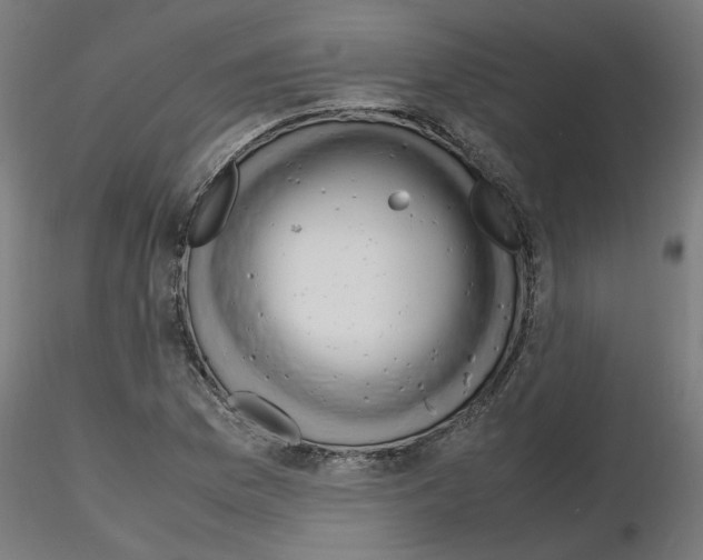 X0000116141169201001041026