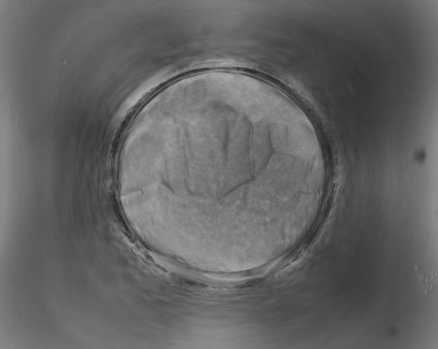 X0000116141173201001041026