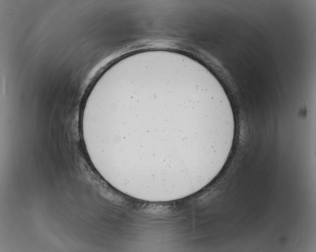 X0000116141174201001041026