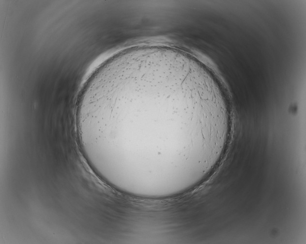 X0000116141176201001041026