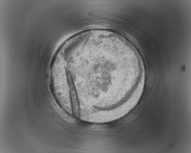 X0000116141179201001041026