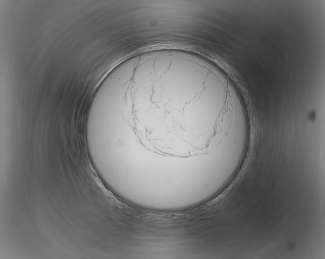 X0000116141185201001041026