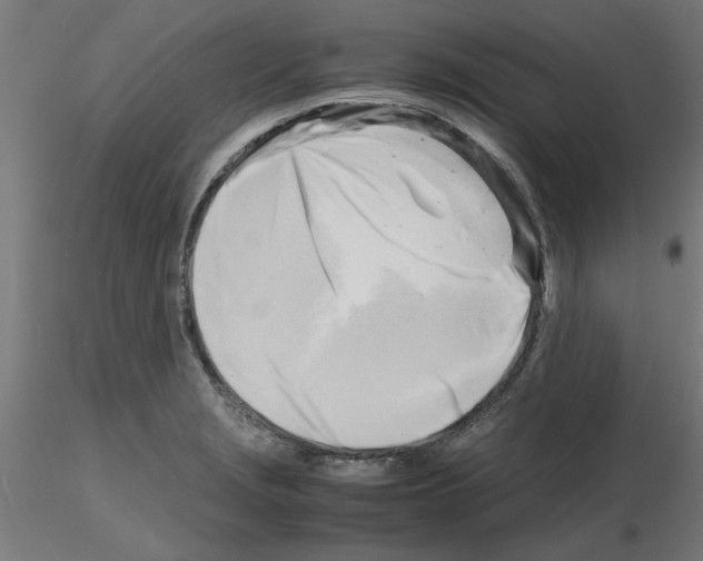 X0000116141229201001041025