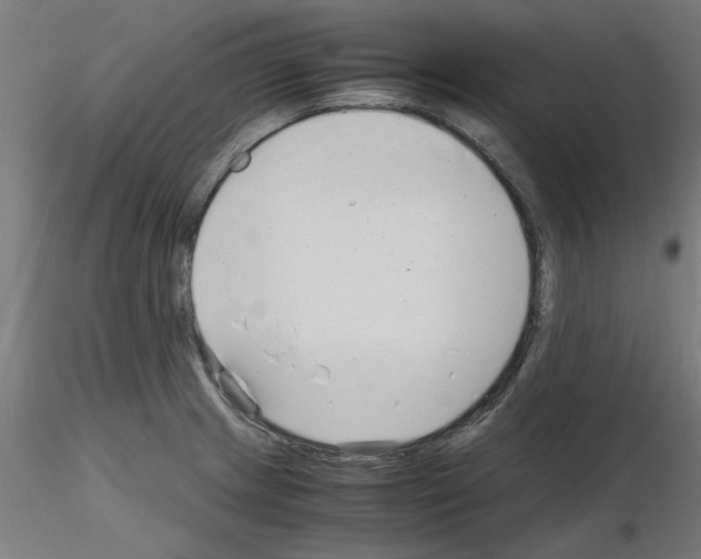 X0000116141233201001041025