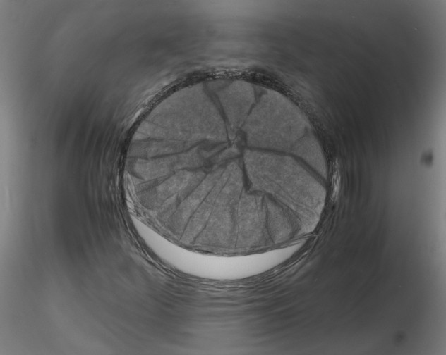 X0000116141252201001041025