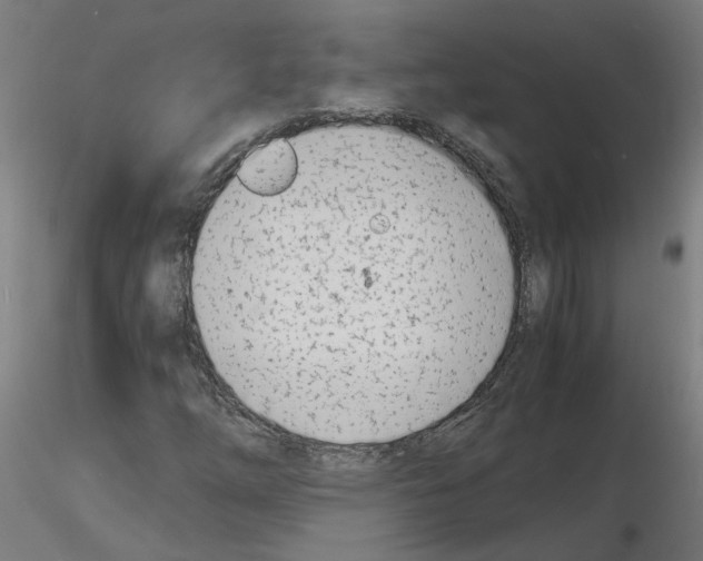 X0000116141254201001041025