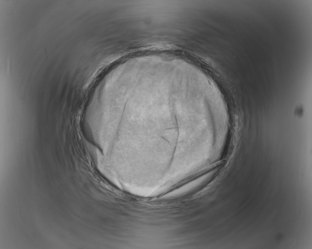 X0000116141257201001041025