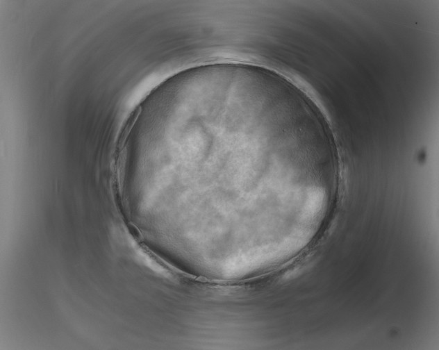 X0000116141381201001041023