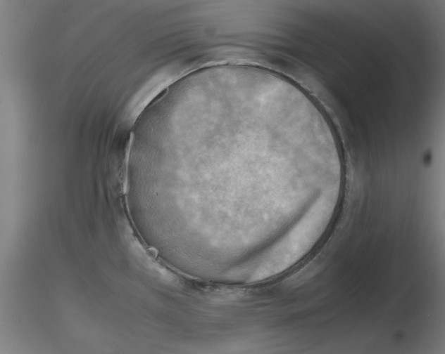 X0000116141385201001041023