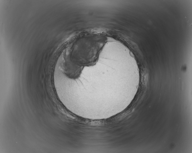 X0000116141393201001041022