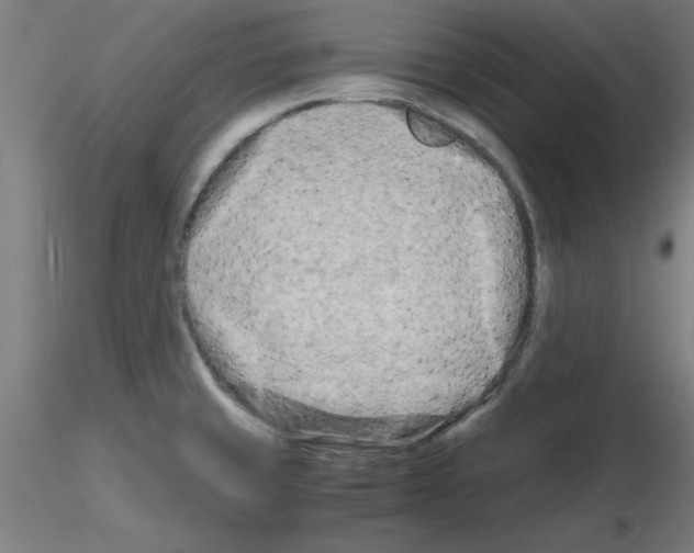 X0000116141429201001041023