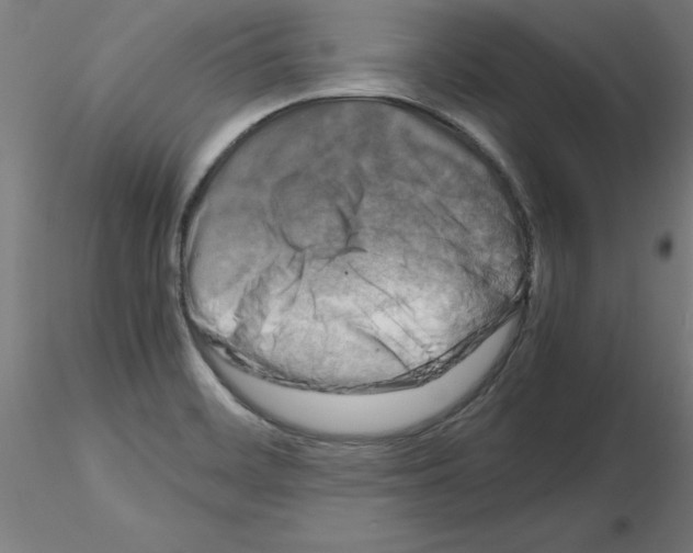 X0000116141468201001041022