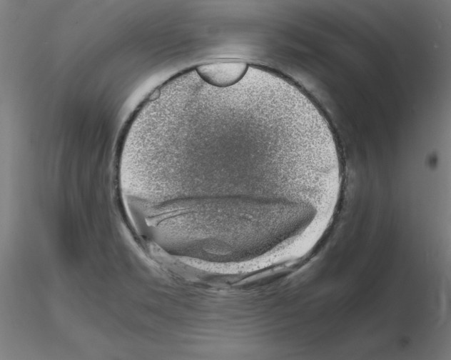 X0000116141469201001041022