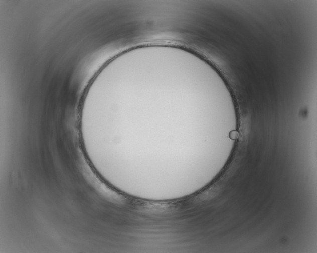 X0000116141470201001041022