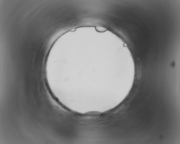 X0000116141471201001041022