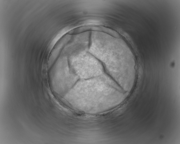 X0000116141473201001041022