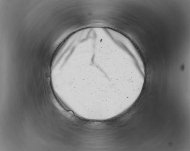 X0000116141476201001041022