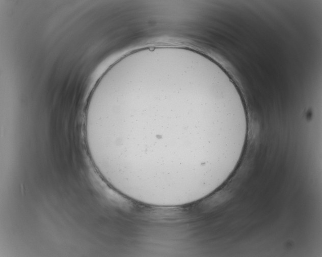 X0000116141486201001041022