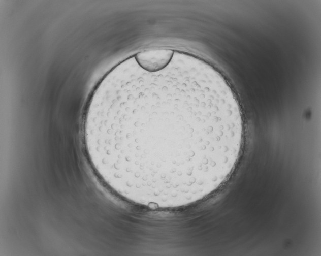 X0000116141517201001041022