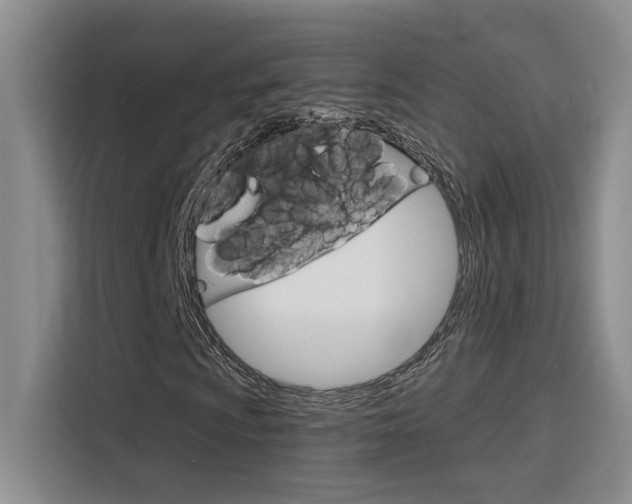 X0000116151009200911230947
