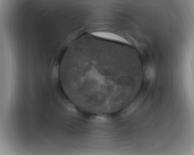 X0000116150475200911231335