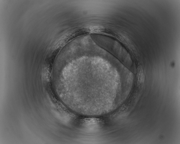 X0000116150316200912141204