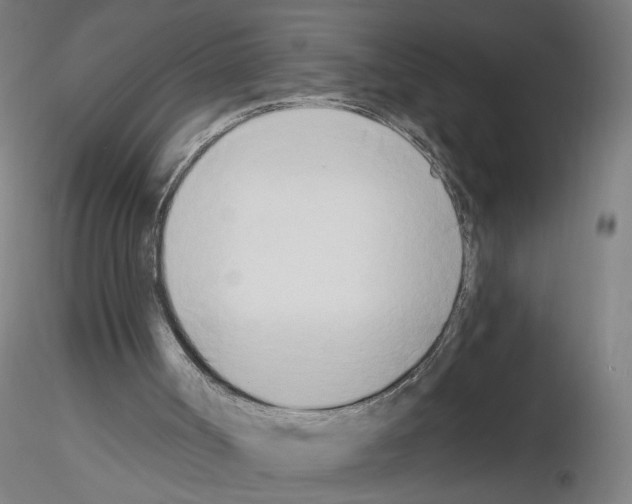 X0000116150002201001041103