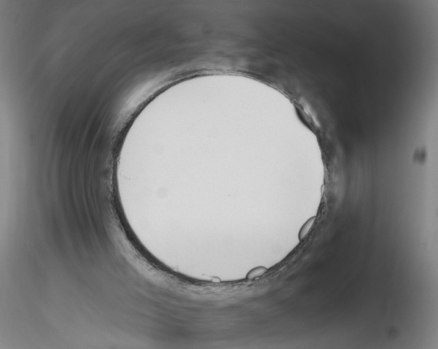 X0000116150005201001041103