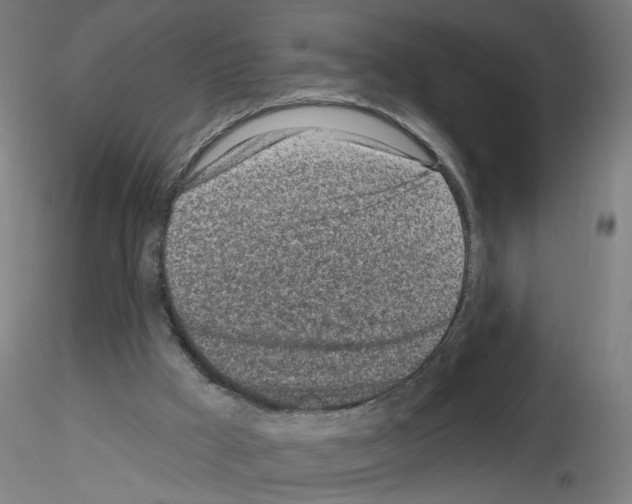 X0000116150009201001041103